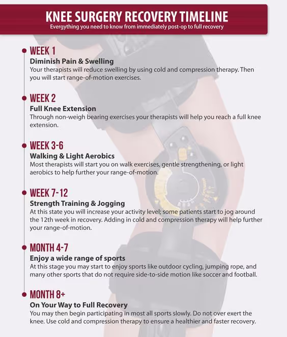 Knee Surgery Recovery Timeline : Need You to Know ? | Knee surgery recovery,  Knee replacement surgery recovery, Knee surgery