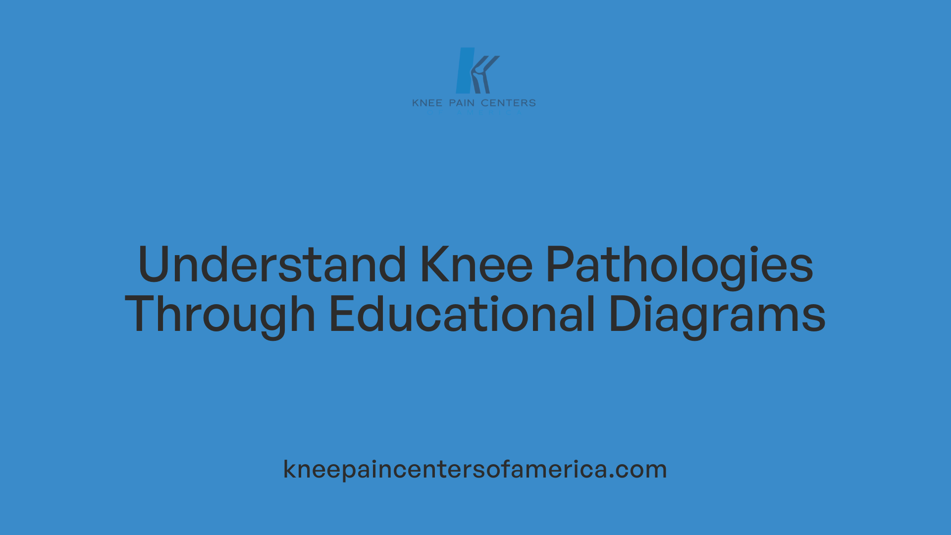 Understand Knee Pathologies Through Educational Diagrams